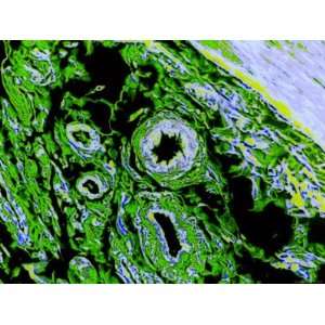 Striated Muscle and Blood Vessels Colored Micrograph Photographic 