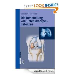 Die Behandlung von Gelenkknorpeldefekten (German Edition) Christoph 