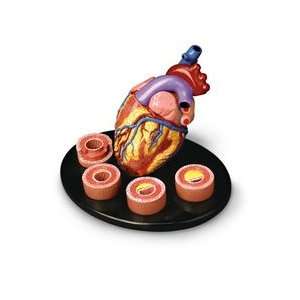 Heart Conditions Model
